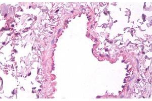 Anti-VEGF antibody IHC staining of human lung, vascular endothelium. (VEGFA anticorps)
