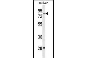 Western blot analysis of ACSS2 Antibody (N-term) (ABIN653559 and ABIN2842938) in mouse liver tissue lysates (35 μg/lane). (ACSS2 anticorps  (N-Term))