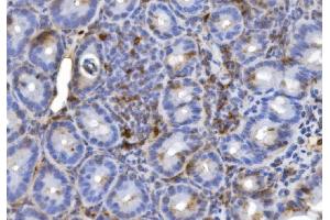 IHC analysis of CD20/MS4A1 using anti-CD20/MS4A1 antibody (ABIN7599223). (CD20 anticorps  (AA 1-291))