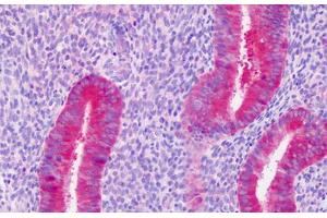 Human Uterus, Endometrium: Formalin-Fixed, Paraffin-Embedded (FFPE) (PAICS anticorps)