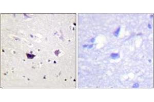 Immunohistochemistry analysis of paraffin-embedded human brain tissue, using PAK1/2/3 (Ab-144/141/139) Antibody. (PAK1/2/3 anticorps  (AA 111-160))