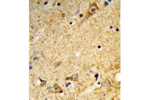 Immunohistochemistry analysis in formalin-fixed and paraffin-embedded human brain tissue reacted with Tricellulin Antibody (C-term) followed which was peroxidase-conjugated to the secondary antibody, followed by DAB staining. (Tricellulin anticorps  (C-Term))