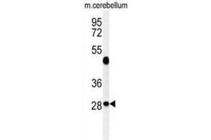 Western Blotting (WB) image for anti-Ras-Related GTP Binding D (RRAGD) antibody (ABIN3002183)