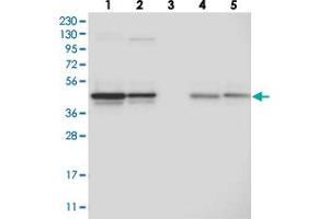 Western blot analysis of Lane 1: RT-4, Lane 2: U-251 MG, Lane 3: Human Plasma, Lane 4: Liver, Lane 5: Tonsil with CCBL2 polyclonal antibody  at 1:250-1:500 dilution.