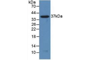 Detection of Recombinant NFkB2, Human using Polyclonal Antibody to Nuclear Factor Kappa B2 (NFkB2)