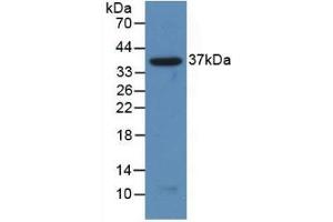 Detection of Recombinant NFkB2, Human using Polyclonal Antibody to Nuclear Factor Kappa B2 (NFkB2) (Nuclear Factor kappa B2 (AA 38-343) anticorps)