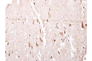 IHC-P Image GABA B Receptor 1 antibody [N2C1], Internal detects GABA B Receptor 1 protein at cytosol on human brain by immunohistochemical analysis.