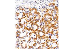 Immunohistochemical analysis of paraffin-embedded R. (Cytochrome C1 anticorps  (AA 142-176))