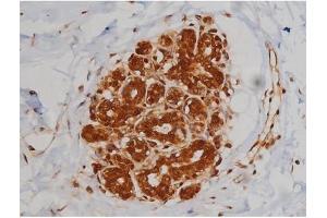 ABIN6267336 at 1/200 staining Human heart tissue sections by IHC-P.