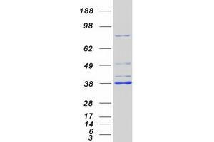 Validation with Western Blot