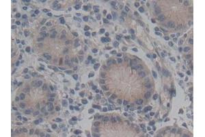 Detection of ABCC2 in Human Stomach Tissue using Polyclonal Antibody to ATP Binding Cassette Transporter C2 (ABCC2)