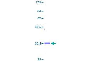 Image no. 1 for NADH Dehydrogenase (Ubiquinone) 1 beta Subcomplex, 1, 7kDa (NDUFB1) (AA 1-58) protein (GST tag) (ABIN1312243)