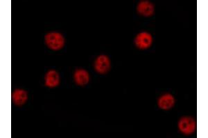 ABIN6274379 staining COLO205 cells by IF/ICC. (MAPKAP Kinase 3 anticorps  (C-Term))