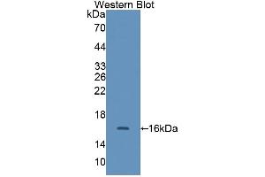 Detection of Recombinant CALD, Rat using Polyclonal Antibody to Caldesmon (CALD)