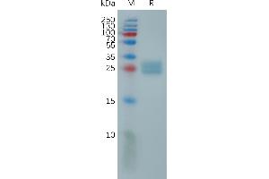 Human U Protein, His Tag on SDS-PAGE under reducing condition.