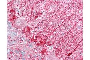 Anti-DBI antibody IHC of human brain, cerebellum.