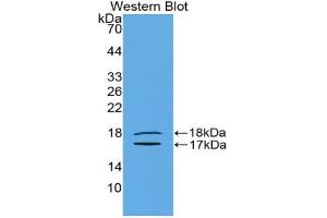 Western blot analysis of the recombinant protein. (INHBE anticorps  (AA 237-350))