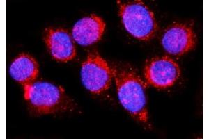 IF analysis of EHD1 using anti-EHD1 antibody (ABIN7602880). (EHD1 anticorps  (C-Term))