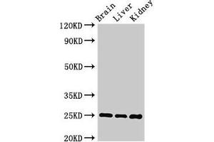 Western Blot Positive WB detected in: Mouse brain tissue, Mouse liver tissue, Mouse kidney tissue All lanes: VAMP7 antibody at 2 μg/mL Secondary Goat polyclonal to rabbit IgG at 1/50000 dilution Predicted band size: 25, 31, 21 kDa Observed band size: 25 kDa (VAMP7 anticorps  (AA 2-186))