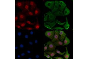 ABIN7094565 and ABIN7098614 staining Hela cells by IF/ICC.
