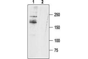 Western blot analysis of rat DRG lysates: - 1. (SCN11A anticorps  (C-Term, Intracellular))