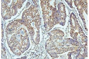 IHC analysis of SAE2/UBA2 using anti-SAE2/UBA2 antibody (ABIN7601755). (UBA2 anticorps  (AA 449-564))