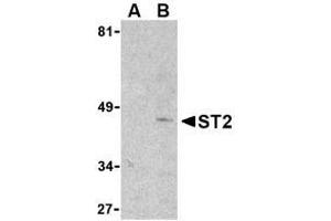 Image no. 1 for anti-Interleukin 1 Receptor-Like 1 (IL1RL1) (N-Term) antibody (ABIN206539) (IL1RL1 anticorps  (N-Term))