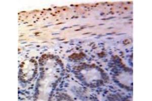 IHC-P analysis of Bowels tissue, with DAB staining. (PML anticorps  (AA 59-239))