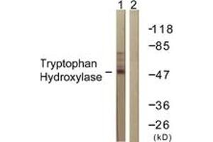 Western blot analysis of extracts from Jurkat cells, using Tryptophan Hydroxylase (Ab-260) Antibody. (Tryptophan Hydroxylase 1 anticorps  (AA 231-280))
