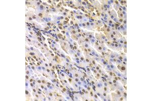 Immunohistochemistry of paraffin-embedded rat kidney using DTNBP1 antibody at dilution of 1:100 (x400 lens).