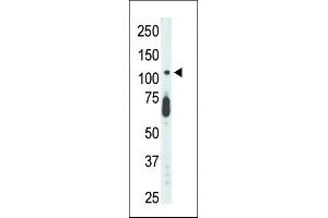 Antibody is used in Western blot to detect STK9 in mouse lung tissue lysate.