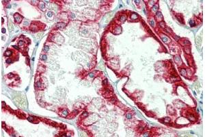 Kidney, Human: Formalin-Fixed, Paraffin-Embedded (FFPE) (Cytokeratin 18 anticorps)