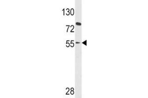 Western blot analysis of PAX8 antibody and HL-60 lysate
