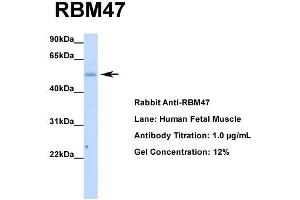 Host: Rabbit  Target Name: RBM47  Sample Tissue: Human Fetal Muscle  Antibody Dilution: 1. (RBM47 anticorps  (Middle Region))