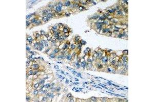Immunohistochemical analysis of NBC1 staining in human prostate formalin fixed paraffin embedded tissue section. (SLC4A4 anticorps)