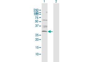Western Blot analysis of CASP3 expression in transfected 293T cell line by CASP3 MaxPab polyclonal antibody.