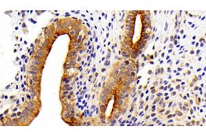 Detection of CK7 in Rat Uterus Tissue using Polyclonal Antibody to Cytokeratin 7 (CK7) (Cytokeratin 7 anticorps  (AA 394-457))