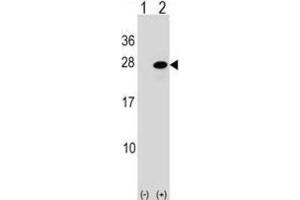 Western Blotting (WB) image for anti-Activating Transcription Factor 3 (ATF3) antibody (ABIN2998842) (ATF3 anticorps)