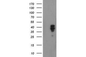 Western Blotting (WB) image for anti-NudE Nuclear Distribution E Homolog (A. Nidulans)-Like 1 (NDEL1) antibody (ABIN1499851) (NDEL1 anticorps)