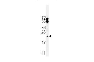 Western blot analysis in WiDr cell line lysates (35ug/lane).