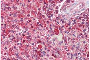 Anti-SNX2 antibody IHC staining of human spleen.