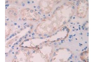 Detection of BCHE in Human Kidney Tissue using Polyclonal Antibody to Butyrylcholinesterase (BCHE)
