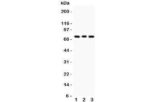 Western blot testing of PKC beta antibody and Lane 1:  rat brain;  2: mouse brain;  3: human COLO320. (Pkc beta 1 anticorps  (AA 542-671))