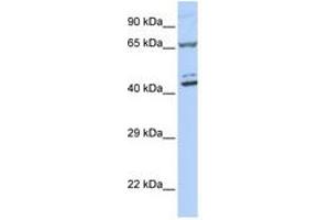 Image no. 1 for anti-Zinc Finger Protein 324 (ZNF324) (AA 180-229) antibody (ABIN6740513) (ZNF324 anticorps  (AA 180-229))