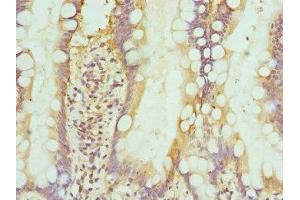 Immunohistochemistry of paraffin-embedded human small intestine tissue using ABIN7156393 at dilution of 1:100 (INTS1 anticorps  (AA 451-710))