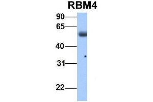 Host:  Rabbit  Target Name:  RBM4  Sample Type:  Human Adult Placenta  Antibody Dilution:  1. (RBM4 anticorps  (Middle Region))