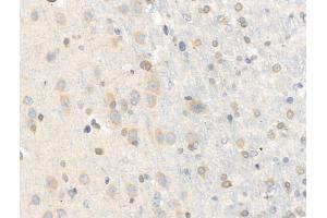 anti-Chordin (CHRD) (N-Term) antibody