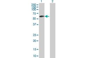 Western Blot analysis of ZBTB6 expression in transfected 293T cell line by ZBTB6 MaxPab polyclonal antibody. (ZBTB6 anticorps  (AA 1-424))