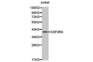 Western Blotting (WB) image for anti-Colony Stimulating Factor 2 Receptor, Alpha, Low-Affinity (Granulocyte-Macrophage) (CSF2RA) antibody (ABIN1872028)