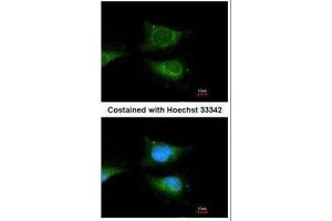 ICC/IF Image Immunofluorescence analysis of methanol-fixed HeLa, using GBA, antibody at 1:100 dilution. (GBA anticorps  (C-Term))
